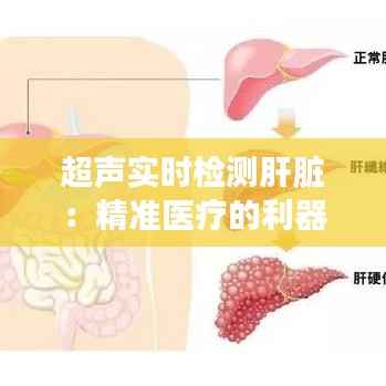 超声实时检测肝脏:精准医疗的利器