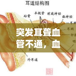 突发耳聋血管不通,血管堵塞导致耳朵听不见可以治愈吗
